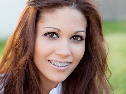 A young woman smiling with braces