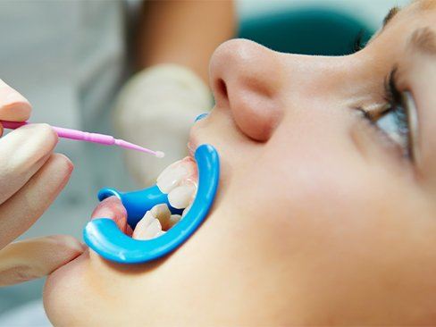 Patient receiving fluoride treatment