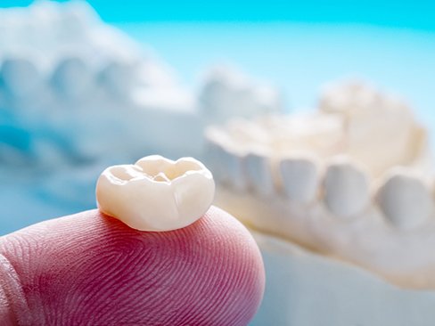 Closeup of dental crown in Dallas on finger