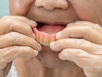 Removable dentures are easy to care for