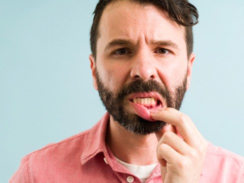 man with swollen gums