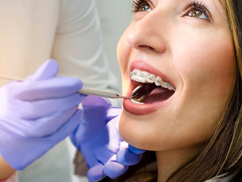 exam of a woman’s braces in Dallas