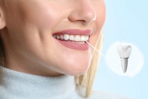 a woman eager to replace a tooth with a dental implant