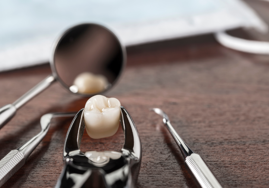 Extracted tooth on forceps